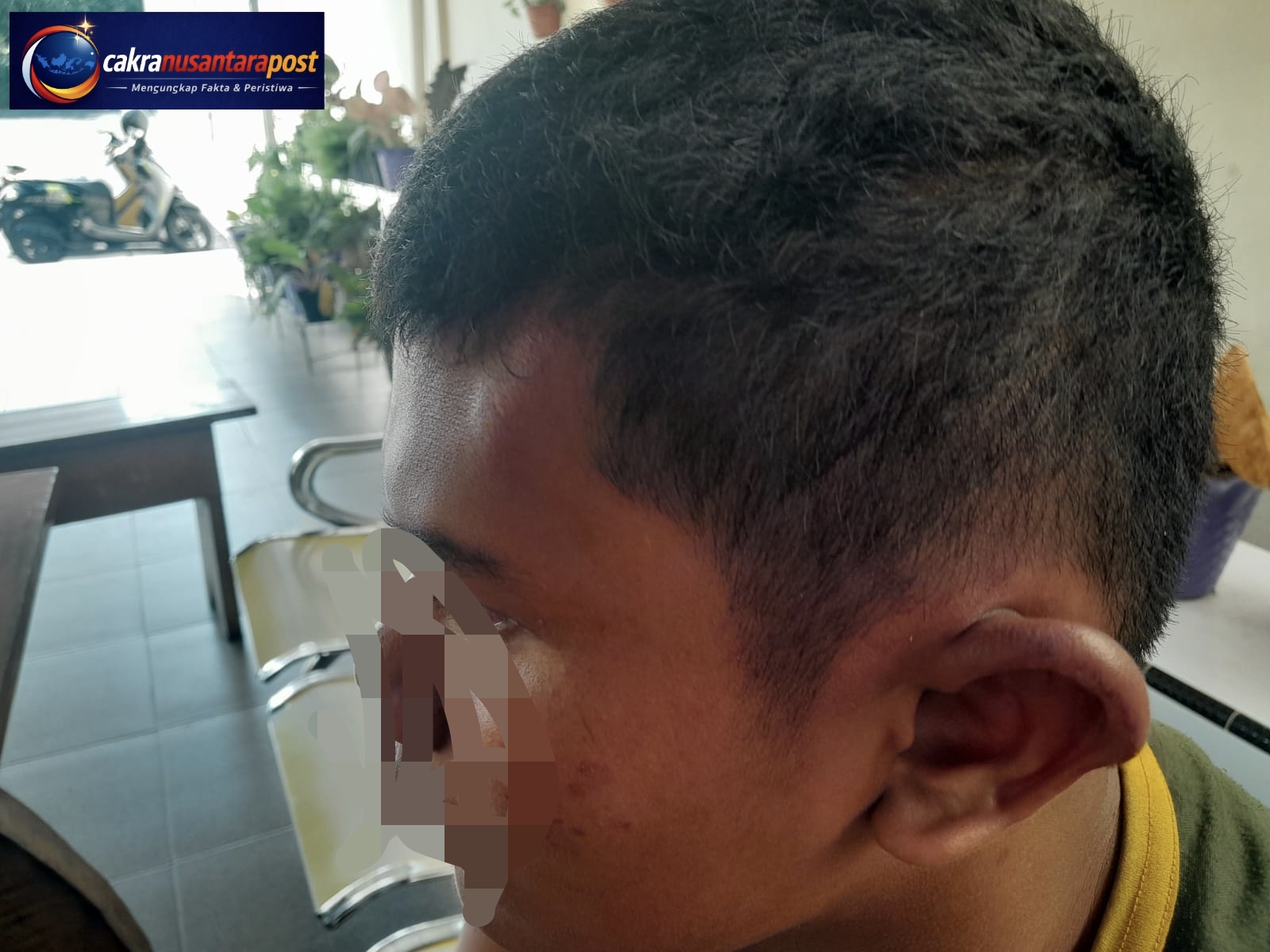 Pihak Keluarga dan Tim Kuasa Hukum Desak Polsek Kuranji Segera Tangkap Tersangka Penganiayaan Anak